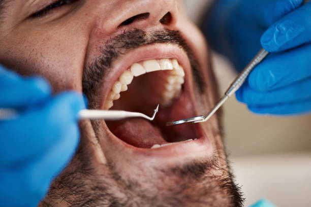 Best Emergency Dental Services for Seniors in Bound Brook, NJ